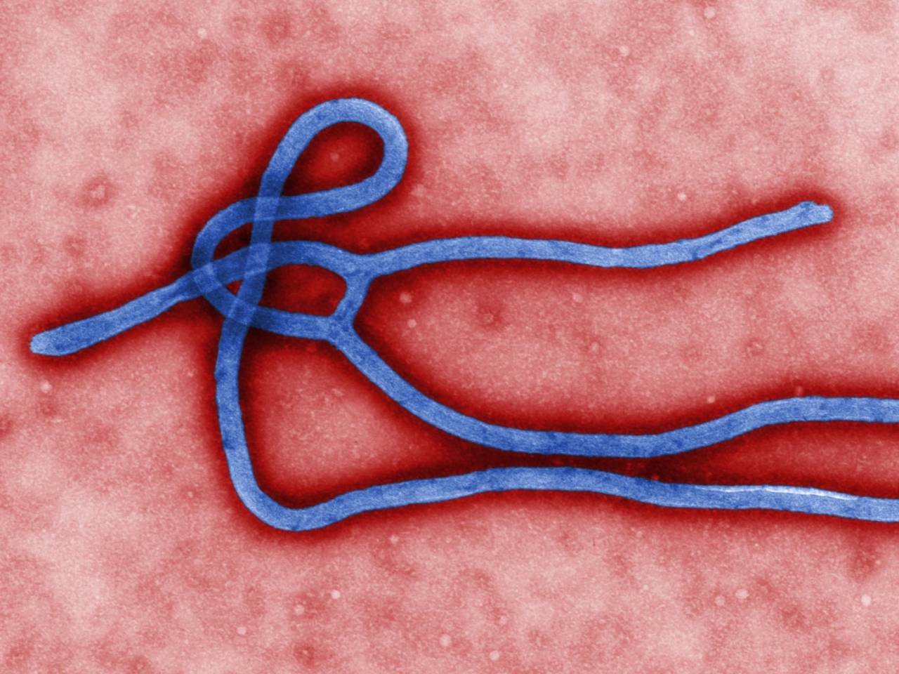 ebola-outbreak-west-africa